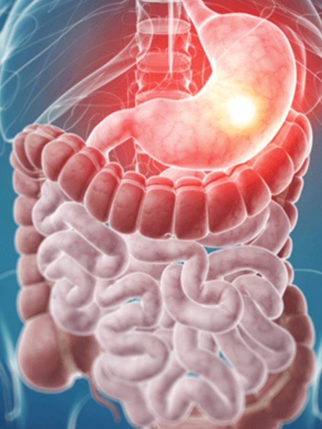 પેટની બળતરા દૂર કરે છે આ વસ્તુઓ