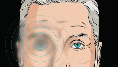 The true cause of the eye