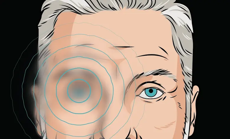 The true cause of the eye