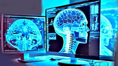 AI in Radiology: Benefits and Risks!