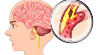 Cases of amoebic meningoencephalitis in Kerala