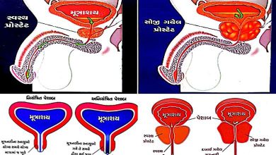 Health Plus: Prostate inflammation, as men age...