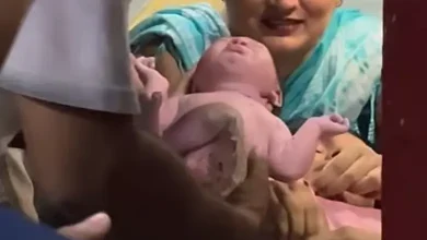 રામમંદિર સ્ટેશન પર જન્મેલું બાળક કૂપર હોસ્પિટલના ICUમાં સારવાર હેઠળ છે, હૃદયમાં કાણું.