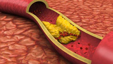 This red fruit will remove cholesterol stuck in the veins, start eating it today...