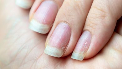 Be careful if you see white horizontal or vertical lines on your nails, this is a sign of a serious illness.
