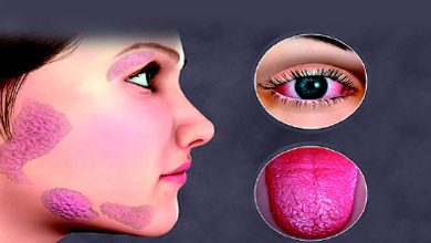 આરોગ્ય એક્સપ્રેસઃ આંખ-મોંઢાને પરેશાન કરતો શોગ્રેન્સ સિન્ડ્રોમ...