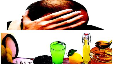 આરોગ્ય પ્લસઃ ખૂબસૂરત વાળને બદ-સૂરત બનાવતા રોગ