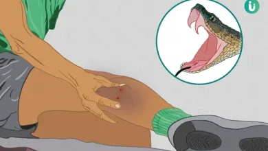 ભુજની અદાણી જી.કે. જનરલ હોસ્પિટલમાં સર્પદંશના દર્દીઓની સારવાર કરતા તબીબો અને હોસ્પિટલનો દૃશ્ય.