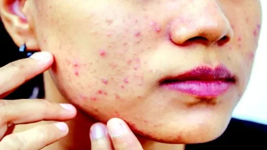 This misconception will prove to be a mistake for skin care