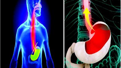 Arogya Express: A common problem that troubles everyone: Acidity