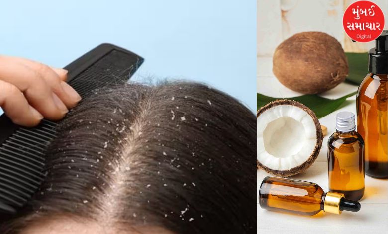 These home remedies will remove your dandruff problem...