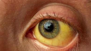 Health officials investigate the sudden rise of 126 jaundice cases reported in Balasinor town, raising fears of a possible outbreak.