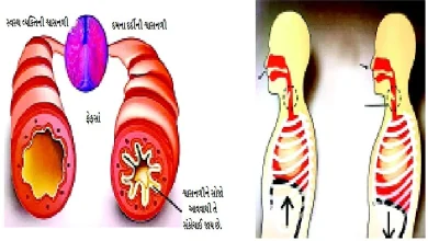 દમ (અસ્થમા) ના લક્ષણો અને આયુર્વેદિક ઉપચાર દર્શાવતો ફોટો