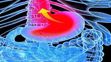 આરોગ્ય એક્સપ્રેસઃ વકરતી ઍસિડિટીનું મુશ્કેલ સ્વરૂપ: GERD જીઈઆર